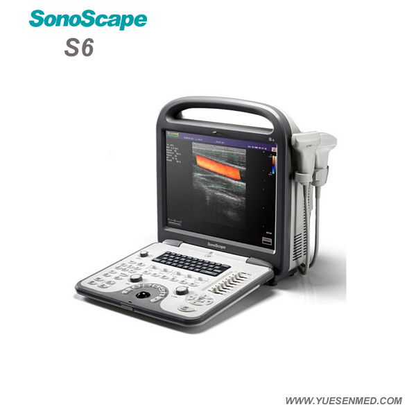 Sonoscape S6 - Sonoscape Portable Color Doppler Ultrasound S6 Price