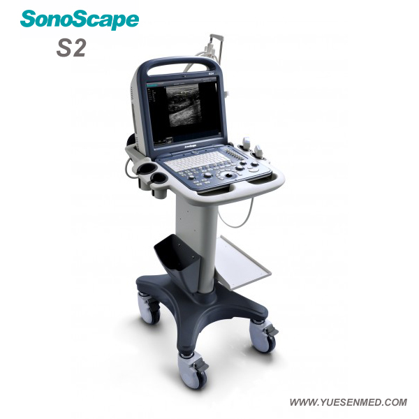 Sonoscape Portable Color Doppler Ultrasound S2 For Sale