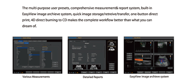 CHISON Q5 STREAMLINED WORKFLOW