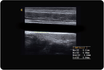 CHISON Q5 STREAMLINED WORKFLOW