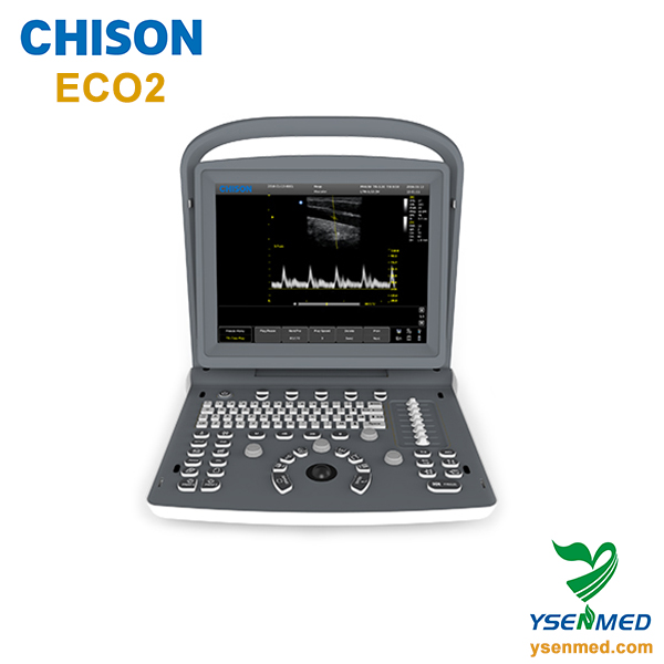 Échographie portative de B/W Chison ECO2 prix