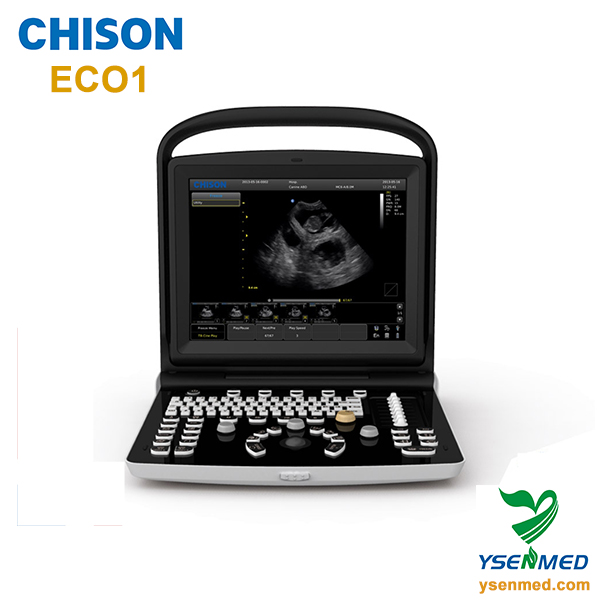chison eco1 ultrasound best prix