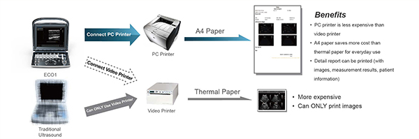 CHISON ECO1 Support PC Printer