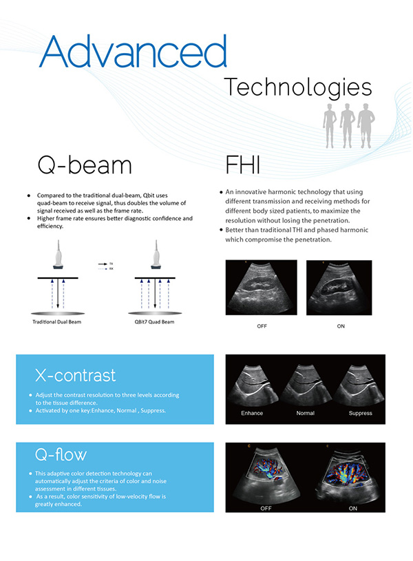 CHISON QBit7 Price - Chison QBit7 ultrasound machine image