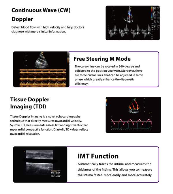 CHISON Q9 PREMIUM CARDIOVASCULAR IMAGING PERFORMANCE