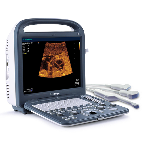 Portable color ultrasound scanner Sonoscape S2