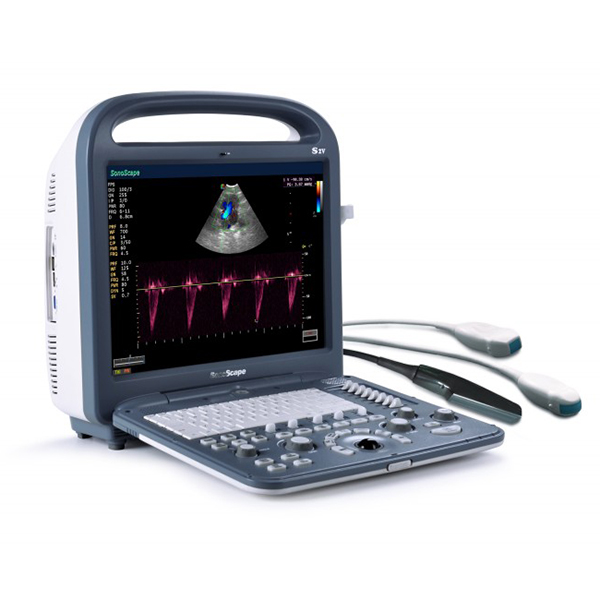 Portable 3d 4d color ultrasound scanner Sonoscape S2