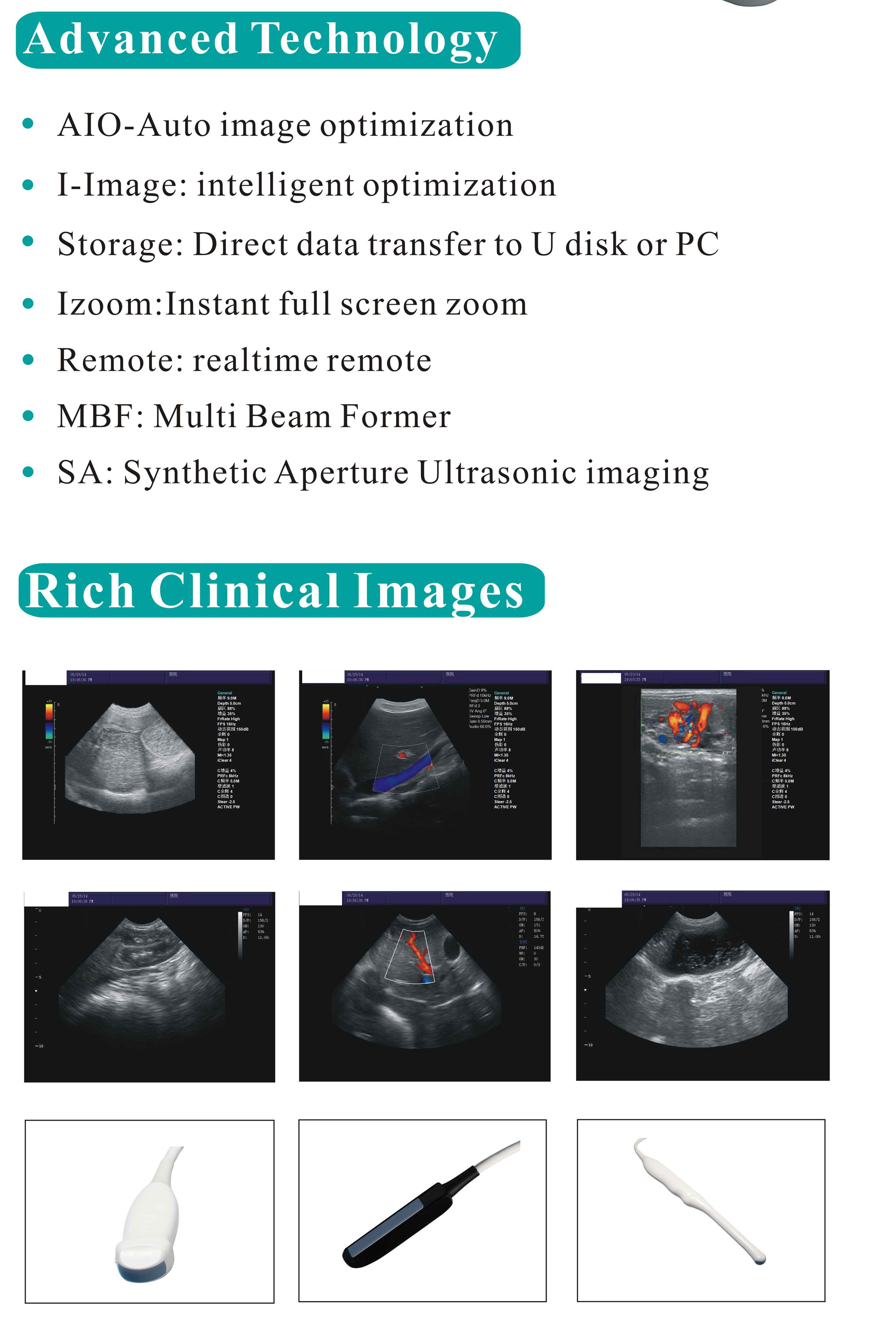 Veterinary Portable color doppler ultrasound YSB-K2000V