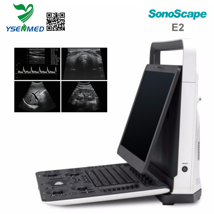 Sonoscape E2 - Sonoscape Portable Color Ultrasound Scanner E2 Price