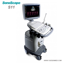 Trolley Color Doppler Ultrasound Machine Sonoscape S11