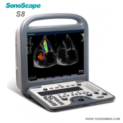 Sonoscape S8 échographie doppler couleur portable S8