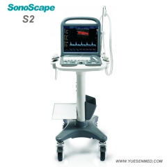 Sonoscape S2 Doppler couleur Portable Ultrasound S2