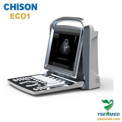 CHISON ECO1 Meilleur prix par ultrasons