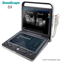 Portable 3D 4D color doppler ultrasound sonoscape S9V