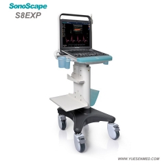 Portable Color Doppler Ultrasound S8Exp