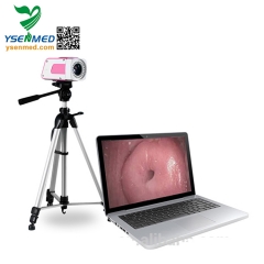 Portable digital colposcope YSSW3301