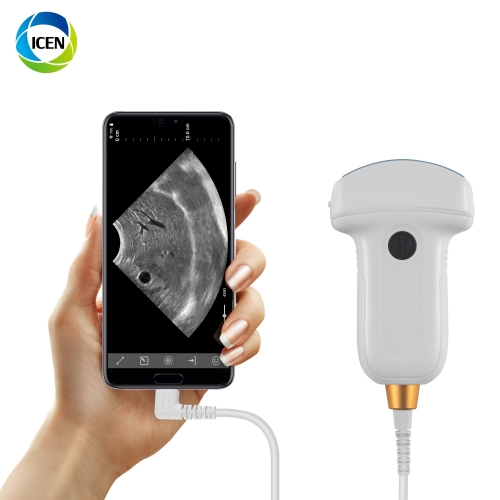 IN-AMX5 Ipad Android wireless ultrasound probe scanner/usb ultrasound probe