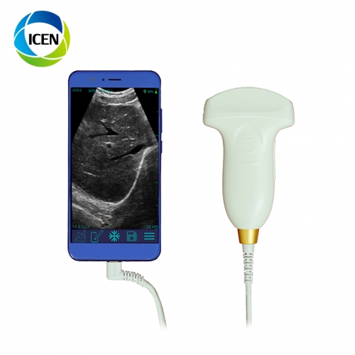 INUC5-2 Laptop USB Port Android Ultrasound Probe Portable USB Ultrasound Scanner