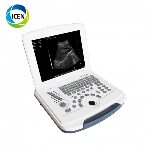 IN-A580 ICEN digital portablePortable vet cow use animals dogs Veterinary ultrasound scanner