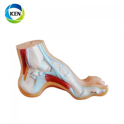 IN-311 PVC medical science teaching flat foot model model anatomical model