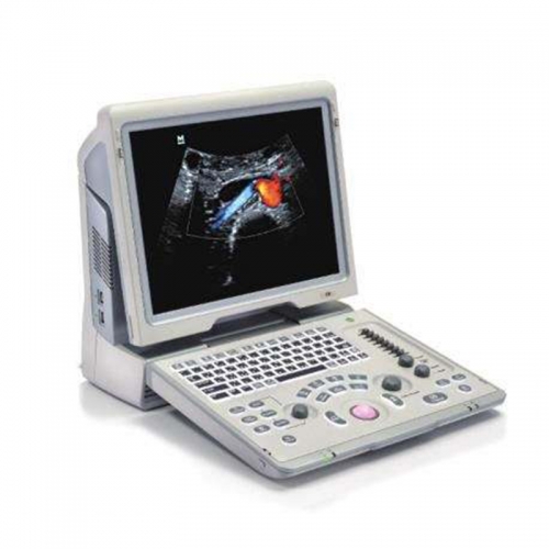 Z6 Mindray Portable Ultrasound Scanner Mindray Z6 Color Doppler Ultrasound Machine