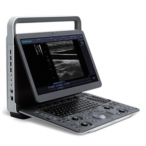 Sistema de ultrasonido portátil en blanco y negro Sonoscape E1 PW