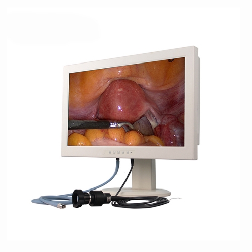 YSGW602 Sistema de cámara de endoscopio médico portátil HD