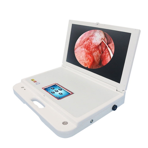 YSGW603 Monitor de cámara de endoscopio médico portátil 4 en 1