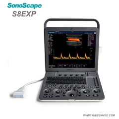 Hot Selling SonoScape S8Exp Portable Color Doppler Ultrasound Machine