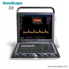 Exploración de la máquina de ultrasonido con carro Sonoscape P40 con sistema doppler color