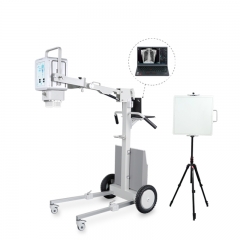 YSX500D haute fréquence 50KW 500mA détecteur à écran plat numérique médical Machine à rayons X