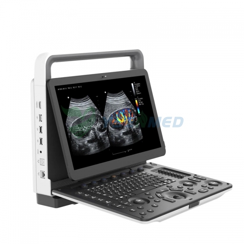 YSB-M70 Cost Effective Portable 4D Color Doppler Ultrasound Scanner