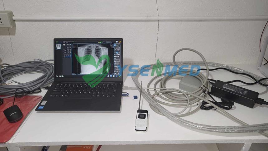 Philippinese doctors are happy with YSENMED YSX056-PE digital portable x-ray unit.