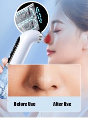 HydraPeel Microdermabrasion Skin Exfolation and Hydration Water Vacuum Hydradermabrasion