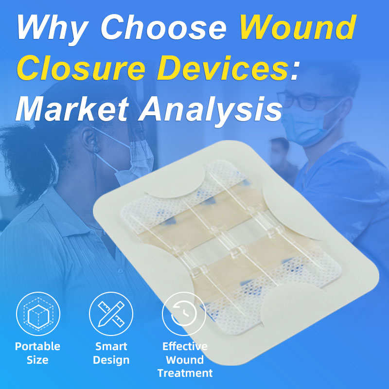 Why Choose Wound Closure Devices: Market Analysis