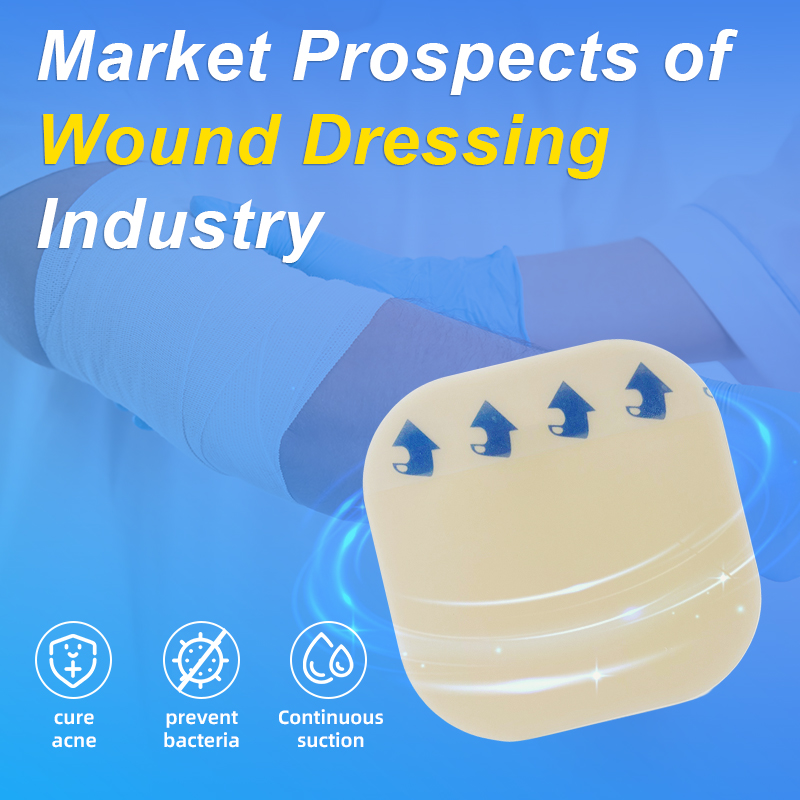Market Prospects of Wound Dressing Industry