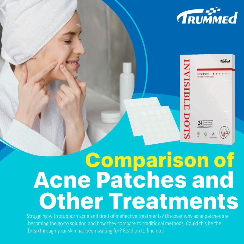 Comparison of Acne Patches and Other Treatments