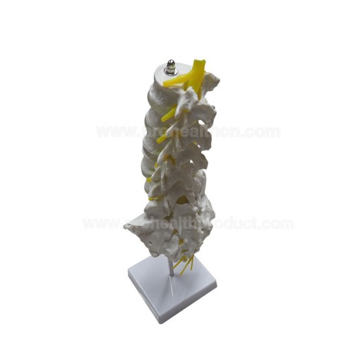 Lumbar Spine Model with 5 Lumbar Vertebrae on Removable Base