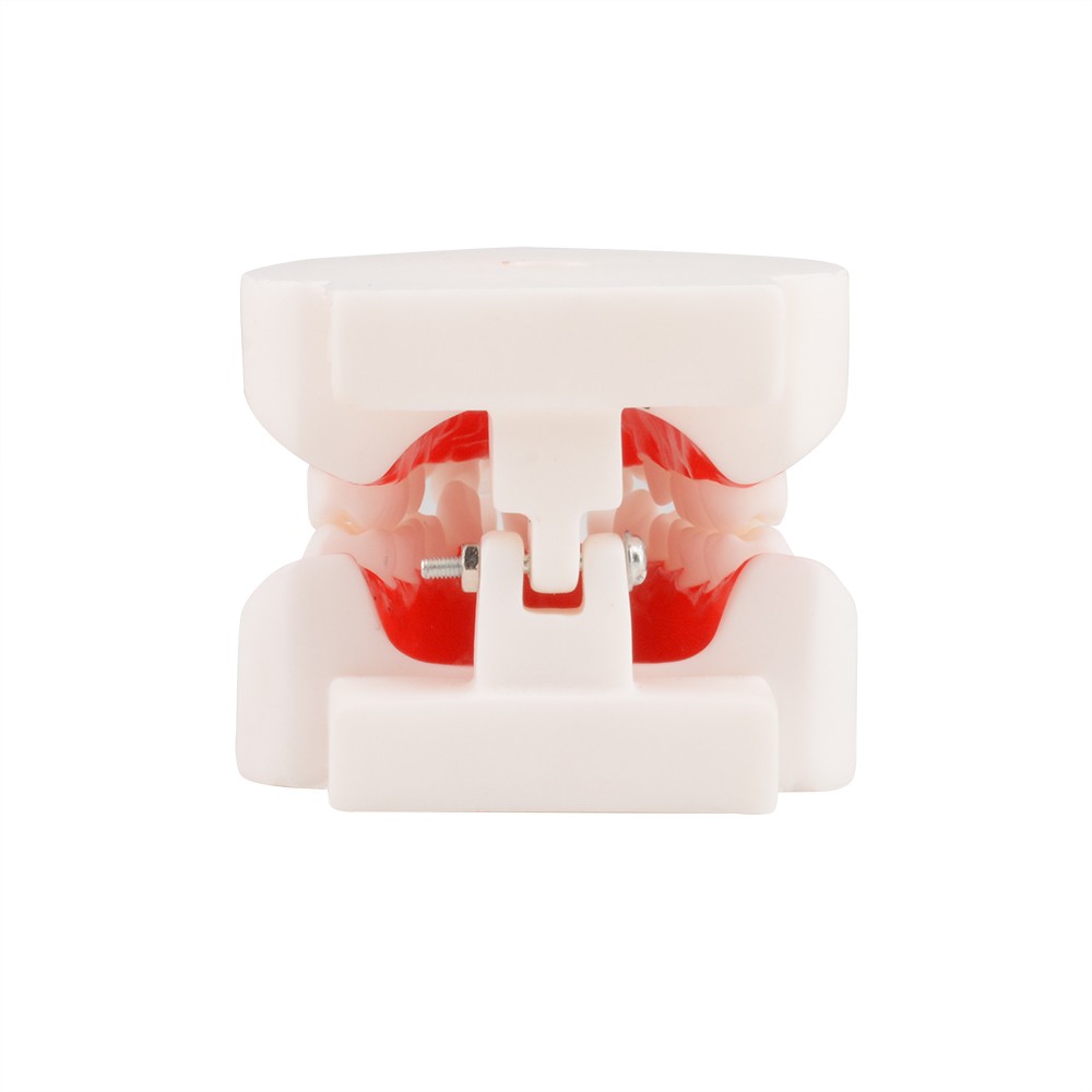 Dental Malocclusion Teeth Model - Distal, Mesial Occlusion Demonstration