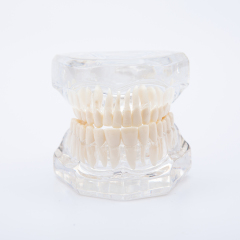 Transparent Human Teeth & Roots Model for Dental Study