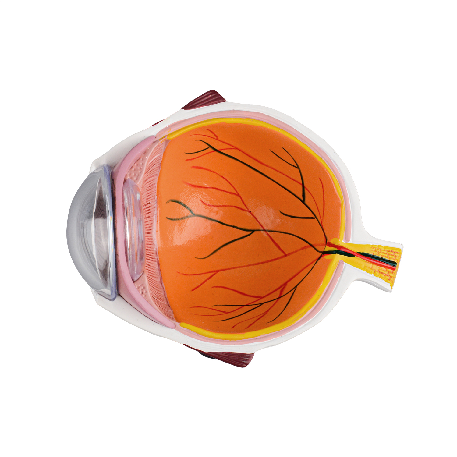 Oversized Human Cataract Eye Anatomy Model for Patient Education