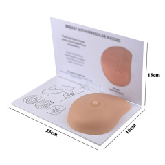 Breast Self Exam(BSE) Model with Irregular Masses