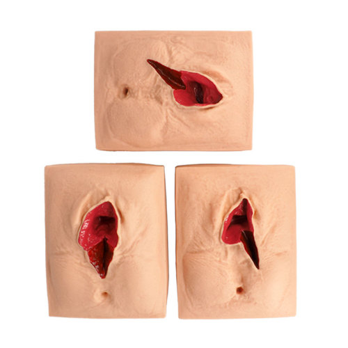 Episiotomy &amp; Perineal Laceration Simulator for Medical Demonstration