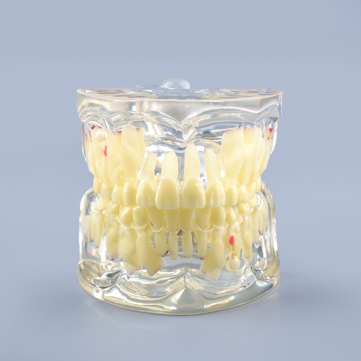 Clear Teaching Disease Teeth Model with Deciduous Teeth