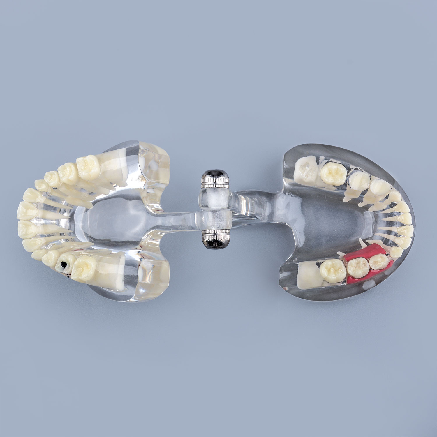 Clear Pathology Teeth Model with Broken Tooth, Root and Gum