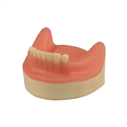 Dental Implant Training Lower Jaw Model