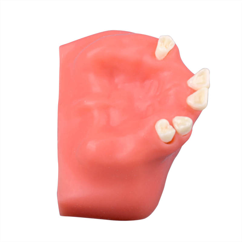 Maxillary Sinus Lift Surgery Implant Practice Model, Missing Teeth 12, 13, 15, 16, 17, 22, 25, 26, 27
