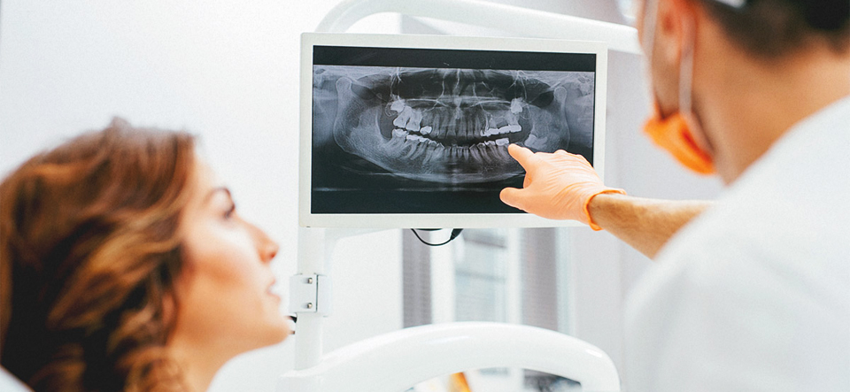 Root Canal Series