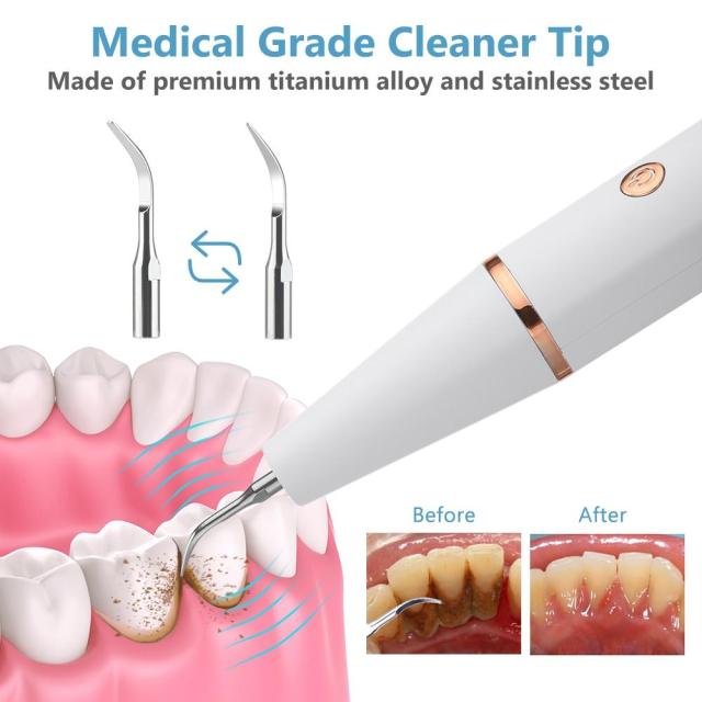 OOVOV Electric Sonic Dental Calculus Scaler Oral Teeth Irrigator Tartar Calculus Remover Plaque Stains Cleaner Remova Teeth Whitening