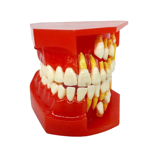 Deciduous Teeth Permanent Tooth Alternate Demonstration Study Teach Model